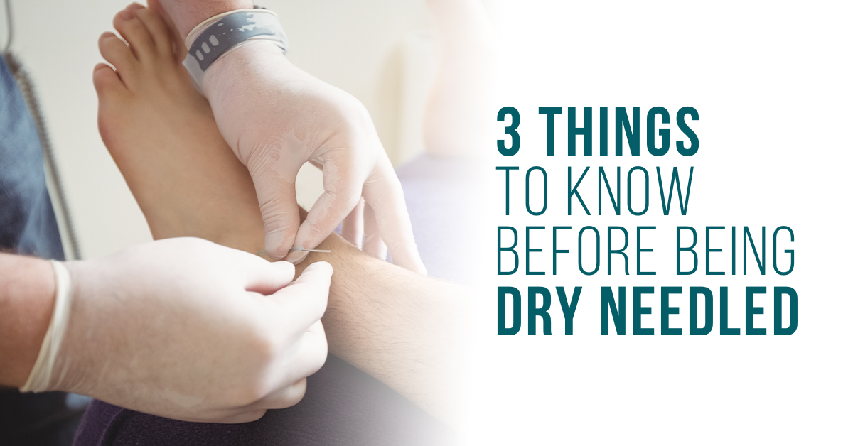 three things to know before being dry needled