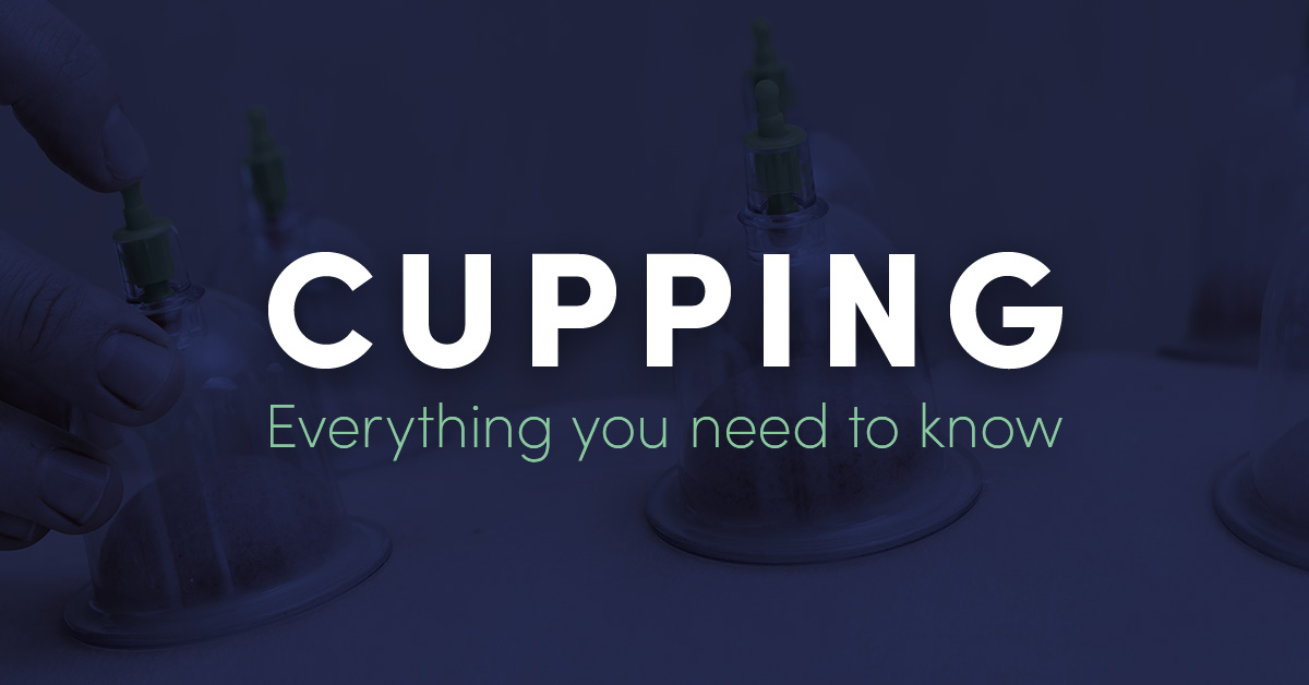 Everything You Need to Know About Cupping
